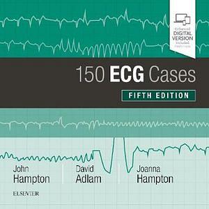 150 ECG Cases by David Adlam & Joanna Hampton & John Hampton BOOK book